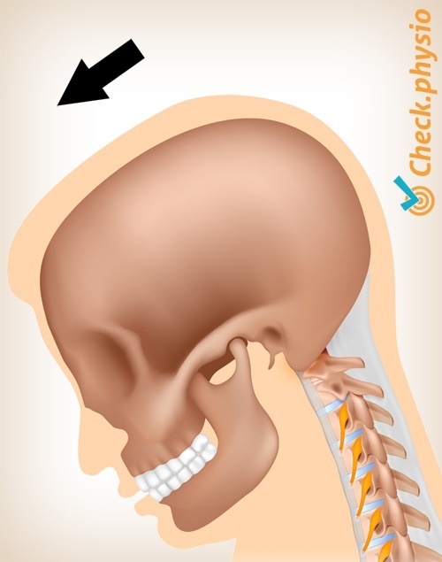 dolor de latigazo cervical movimiento 2