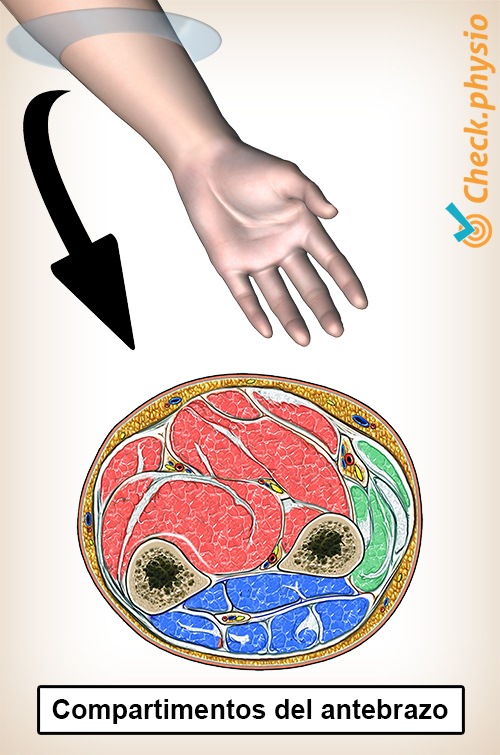 compartimentos del antebrazo